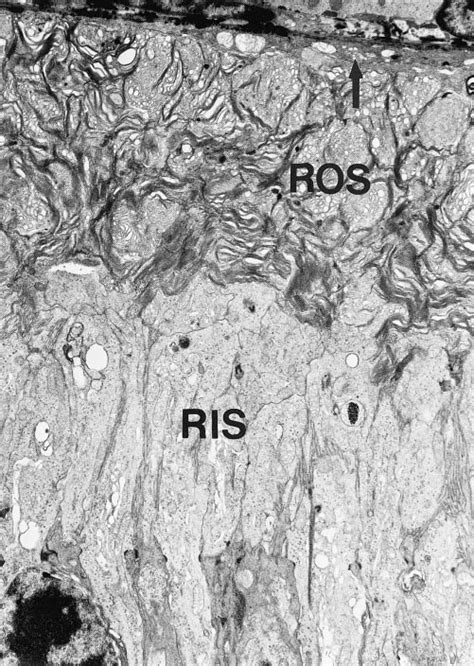 Posterior Retina And Light Treated Rcs Rat At P Pigment Epithelium