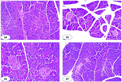 Histopathological Findings Of Rats Pancreas Of The Experimental Groups Download Scientific