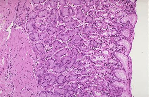 Mucous Membrane Histology