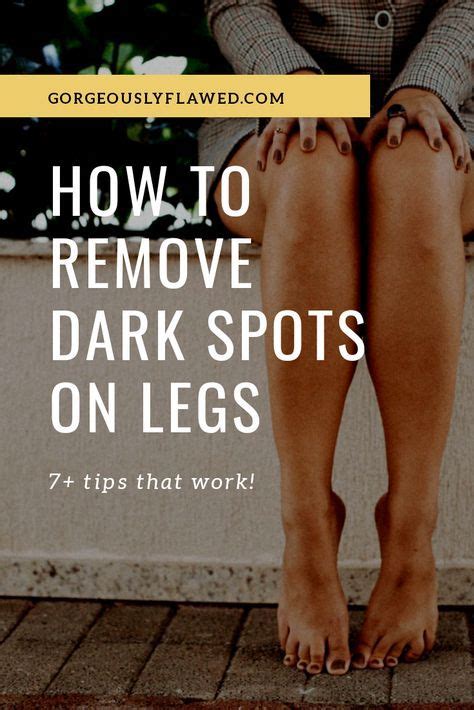 How To Remove Dark Spots On Legs 7 Tips For Legs Scars And Dark Spots