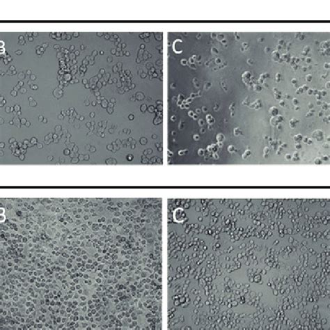 Morphological Analysis Of U87 Mg And U251 Cell Lines After 24 H