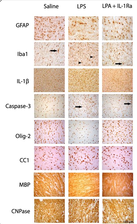 Representative Photomicrographs Showing Positive Staining Of Gfap