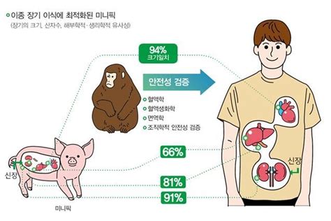 이종장기이식 유용성 및 안전성 검증 연구로 난치성 질환 극복 기대