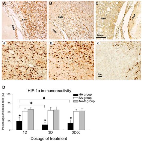 Representative Immunohistochemical Sections Of Hypoxia Inducible