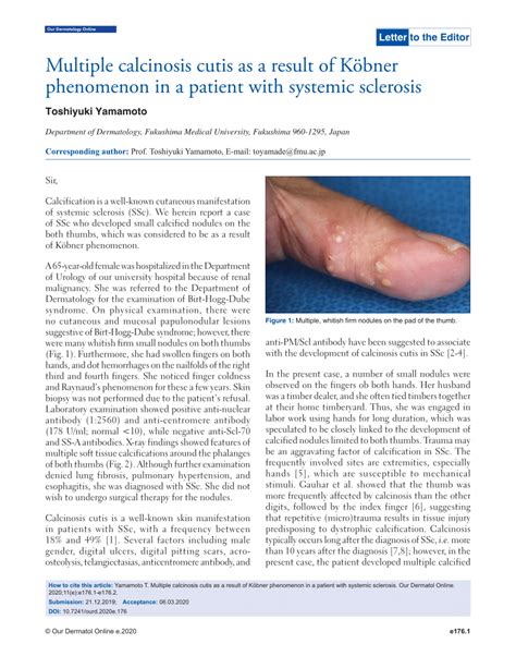 Pdf Multiple Calcinosis Cutis As A Result Of K Bner Phenomenon In A