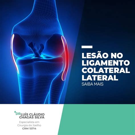 Lesão no Ligamento Colateral Saiba Mais Drº Luis CLaudio Chagas