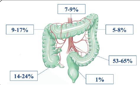 Location And Frequency Of Iatrogenic Colonoscopy Perforation Download Scientific Diagram