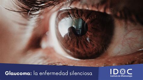 Glaucoma La Enfermedad Silenciosa Idoc Cirugía Lasik Cataratas Y