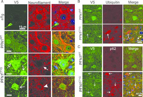 Cytoskeletal Alterations And Proteostress Are Observed In The Motor