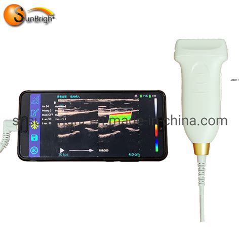 2020 Handheld Color Doppler Ultrasound Probe Wireless Scanner Portable Ultrasound Probe And