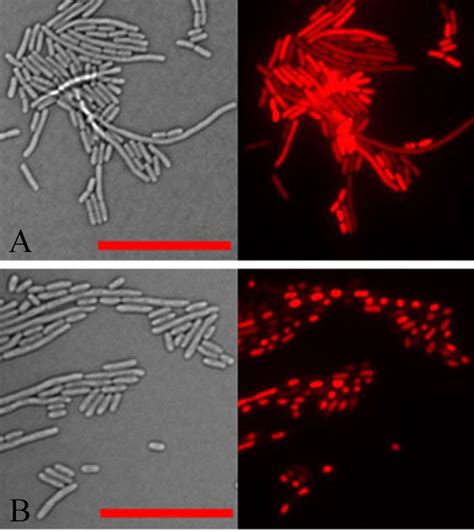 Microscope Images Of E Coli E IMAGE EurekAlert Science News Releases