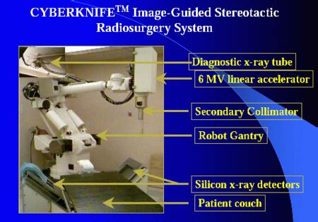 Stereotactic Radiation Therapy