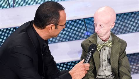 Morto Sammy Basso A Sanremo Nel 2015 Aveva Detto La Mia Forza è La