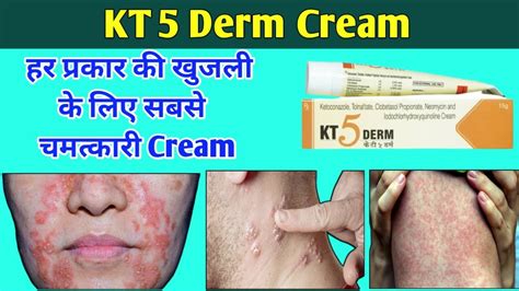 Kt Derm Cream Uses In Hindi Kt Derm Se Kya Hota Hai Kt Derm