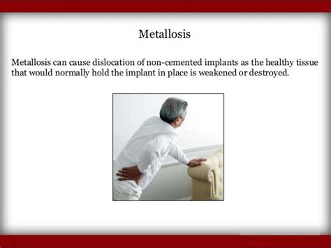 Symptoms of Hip Replacement Implant Recall