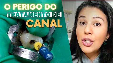 Tratamento De Canal Descubra Coisas Importantes Antes De Ir Ao