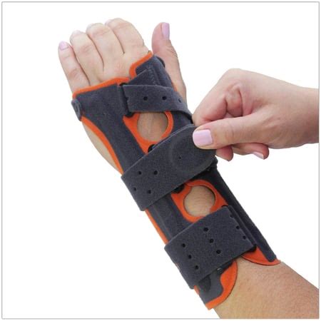 Splint Immobilization For Treatment of a Scapholunate Ligament Injury