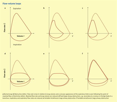 Tests Of Pulmonary Function Before Thoracic Surgery Anaesthesia