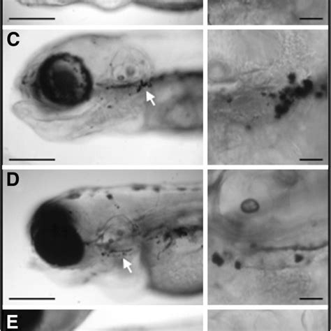 Lateral views from zebrafish insertional mutants for five V-ATPase ...