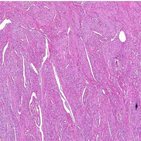 Smooth Muscle Histology Slide at Rs 500/piece | Prepared Microscope ...