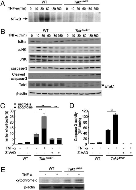 Disruption Of Tak1 In Hepatocytes Causes Hepatic Injury Inflammation