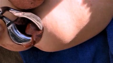 Extreme Anal Fisting For My Loose Sloppy Asshole