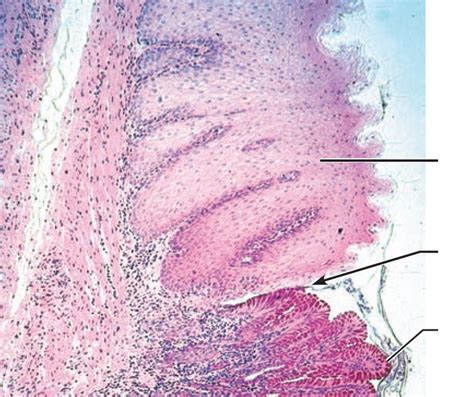 A&P BIOL 2312 Esophagus-Stomach Junction Diagram | Quizlet