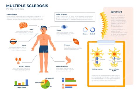 Infografía De Esclerosis Múltiple De Diseño Plano Vector Premium