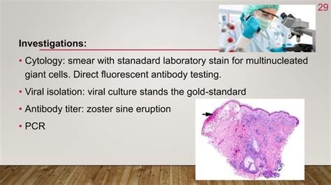 Vesiculo Bullous Lesions Of Oral Cavity Ppt