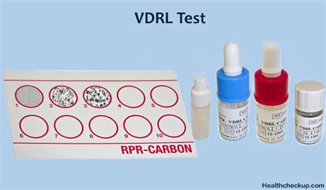 What Is A Vdrl Test Procedure Purpose Results Interpretation