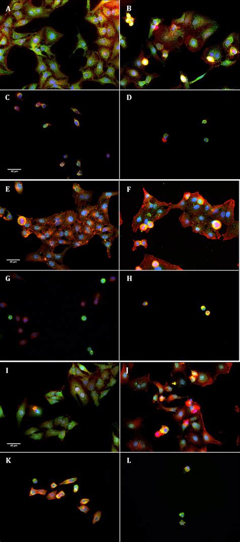 Immunofluorescence Of Cytochrome C A B C D Active Caspase E