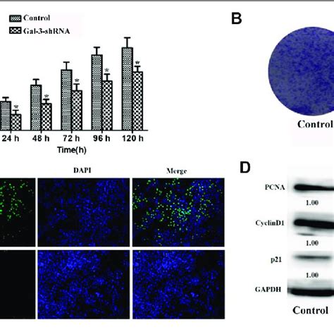 Knockdown Of Gal Inhibits The Proliferation Ability Of Icc Cells