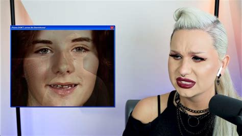 She Lost All Her Teeth The Swan Plastic Surgery S2 E6 Luxeria Youtube