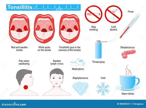 Tonsils Cartoons, Illustrations & Vector Stock Images - 89 Pictures to ...