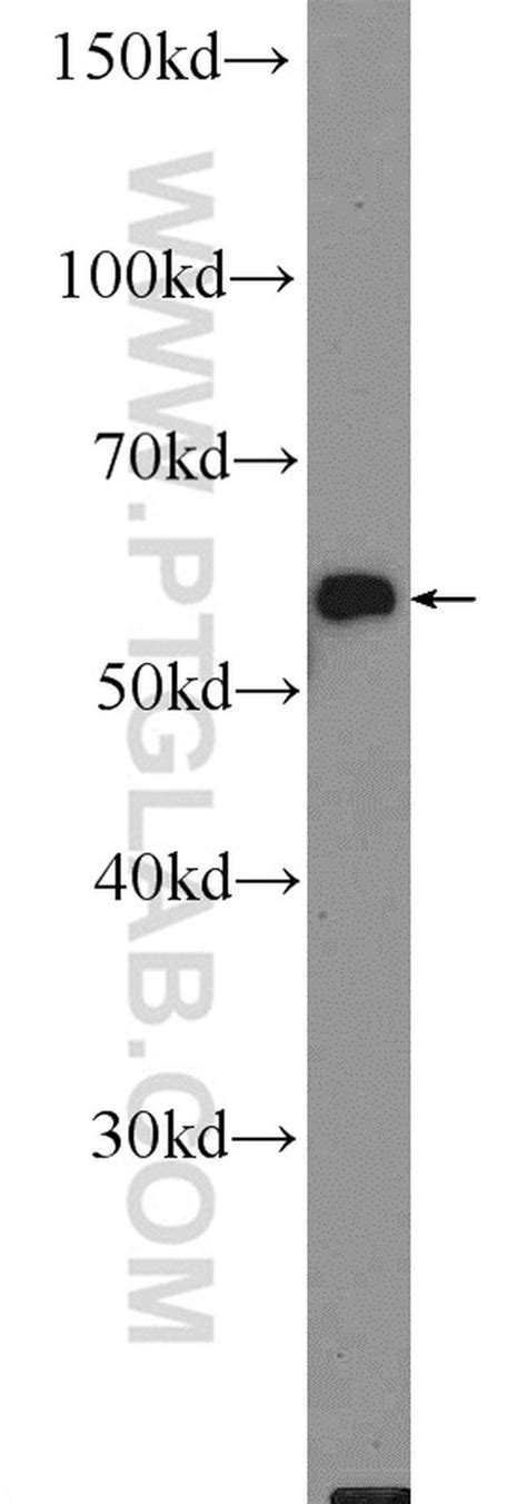 HMCN1 Rabbit anti Human Mouse Rat Polyclonal Proteintech 150 μL