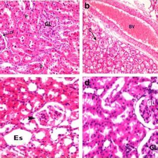 Histopathological Effect Of Se NPs On CdCl2 Induced Renal Damage In