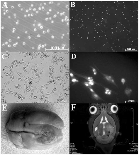 Glioma C Glioma Cells