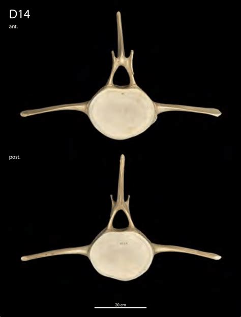 Anterior Ant And Posterior Post Surfaces Of The 14th Thoracic