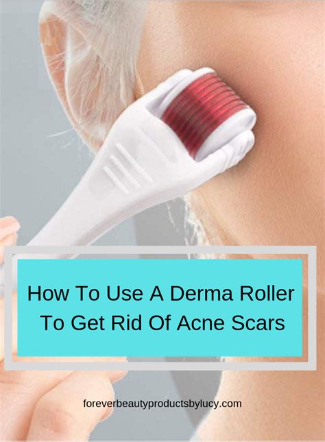 How To Use A Derma Roller For Acne Scars Forever Beauty Products By Lucy