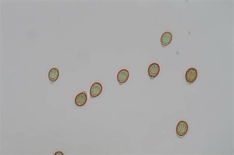 El Mundo Microsc Pico De Los Hongos Ganoderma Lucidum Curt Ex Fr Karst