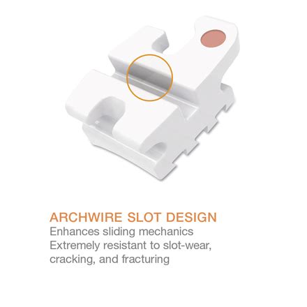 OrthoFlex Composite Bracket System Ortho Technology