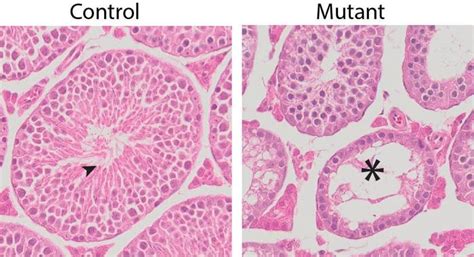 Normal Seminiferous Tubules In Image Eurekalert Science News Releases