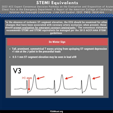 Stemi Equivalent Update 2022 Acc Consensus Statement Foamcast