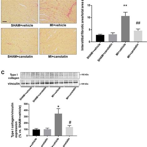 Canstatin Improves Survival Rate After Myocardial Infarction MI MI