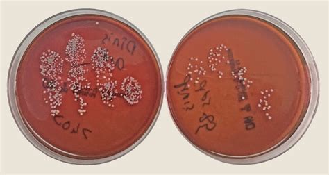 Painting In A Petri Dish Science In School