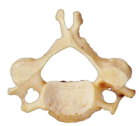 Bone Markings Cervical Vertebrae Diagram Quizlet