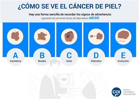 como comienza el cancer de piel primeros sintomas  como se ve