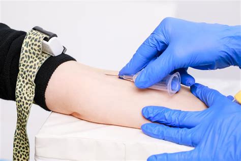 Venipuncture Wikipedia Informacionpublica Svet Gob Gt