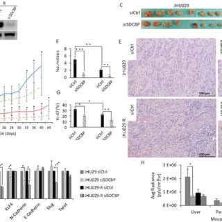 SDCBP Inhibition Reduced Tumor Growth A Western Blot Of JHU029 And