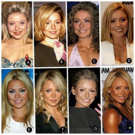 Megyn Kelly facelift before and after photos ~ Celebrity Plastic ...